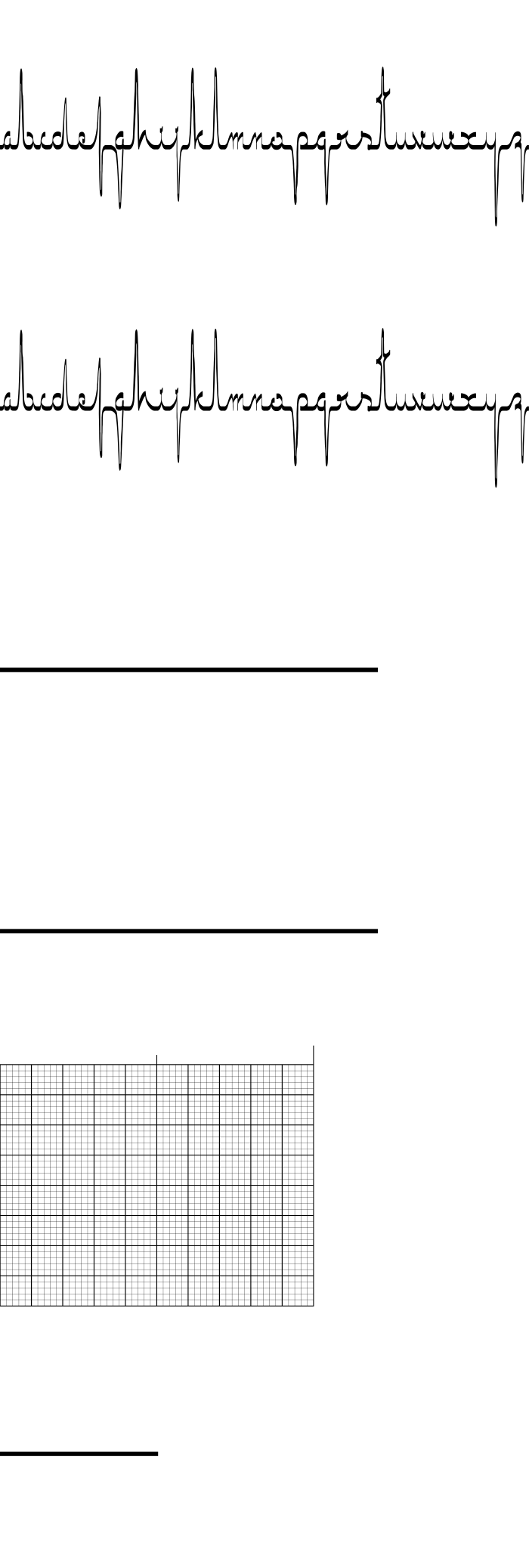 Font ECG saji